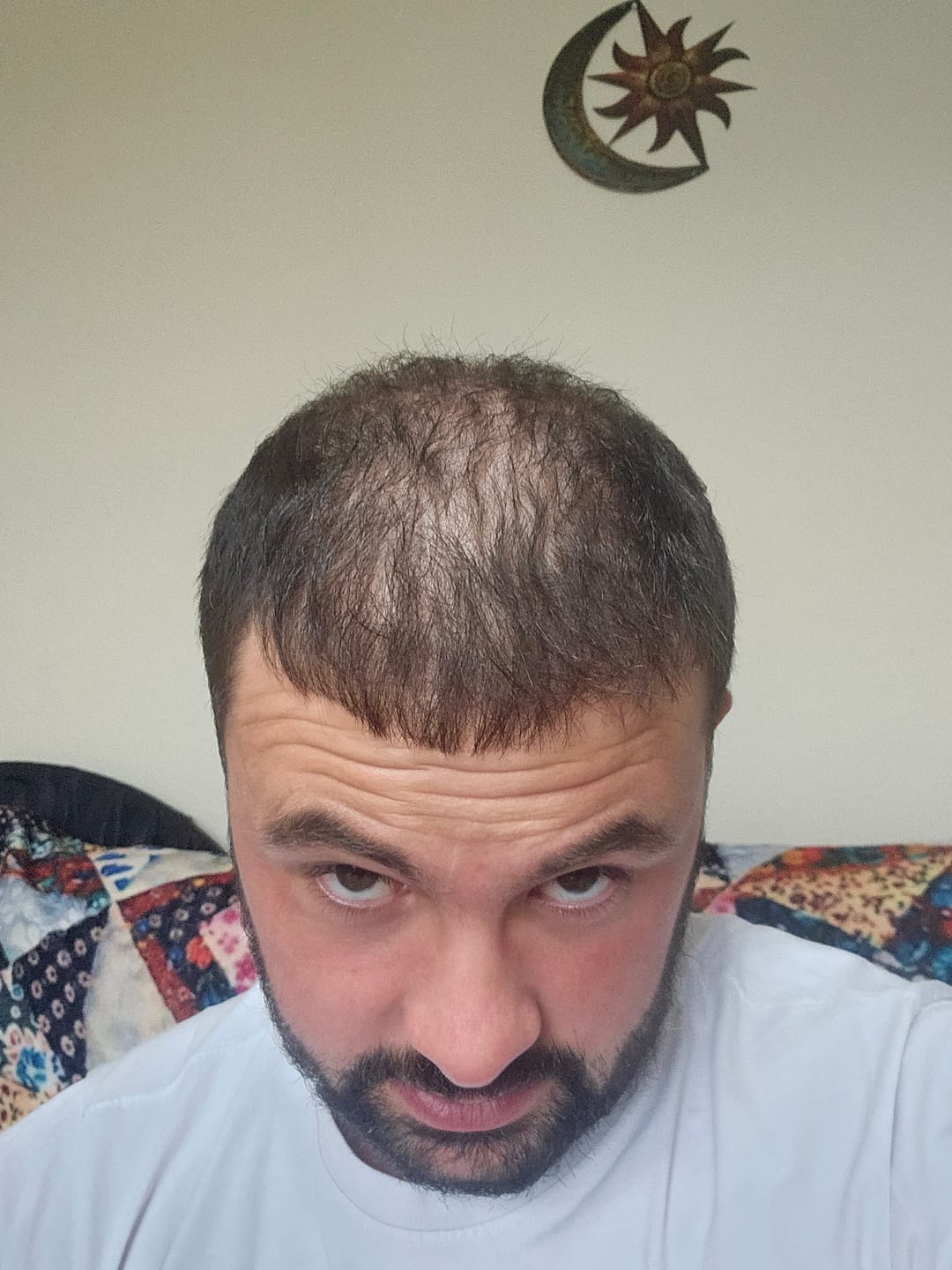 Customer photo review of Volumane Anti-Thinning Stimulating Shampoo