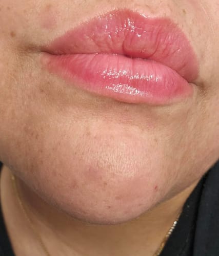 Customer photo review of Korean Hydrating Lip Stain Oil