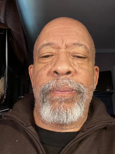 Customer photo review of Berry White  - 28 Grams - Indica