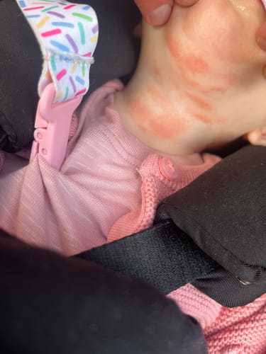 Customer photo review of Calm Balm