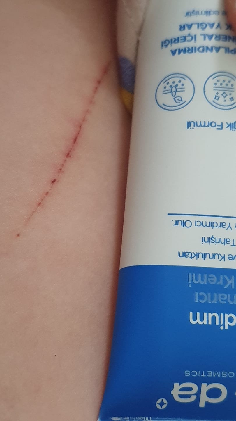 Customer photo review of Remedium SOS Onarıcı Bakım Kremi