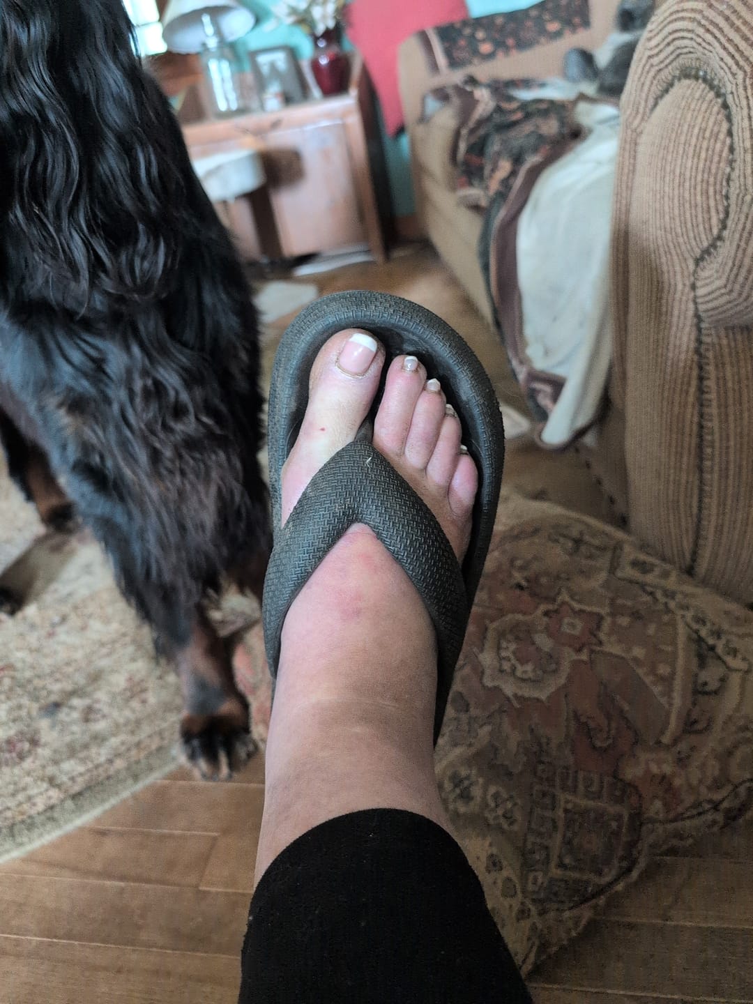 Customer photo review of Cushion Flip Flops - Cloud Slides