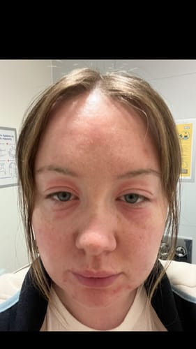 Customer photo review of Calm Balm