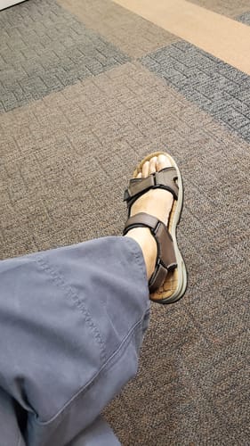 Customer photo review of 💯Summer Collection 💯Men's Orthopedic Leather Sandals – Breathable, Adjustable, Air Cushion