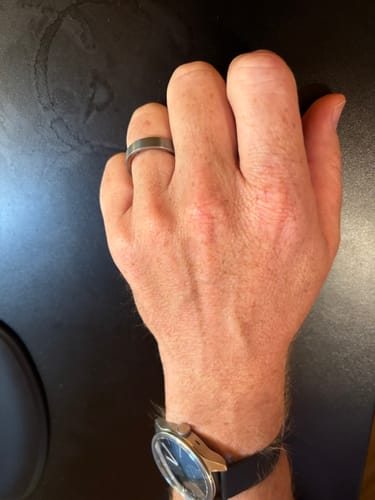 Customer photo review of Warrantied Ring Replacement