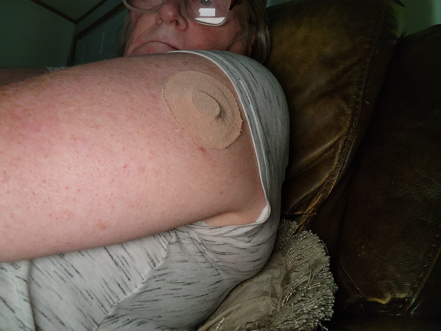 Customer photo review of Skin Grip Original - Dexcom G7 & Stelo Adhesive Patches