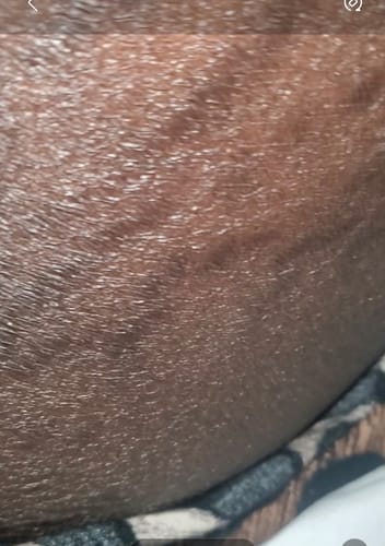 Customer photo review of Peeling savon noir anti vergetures