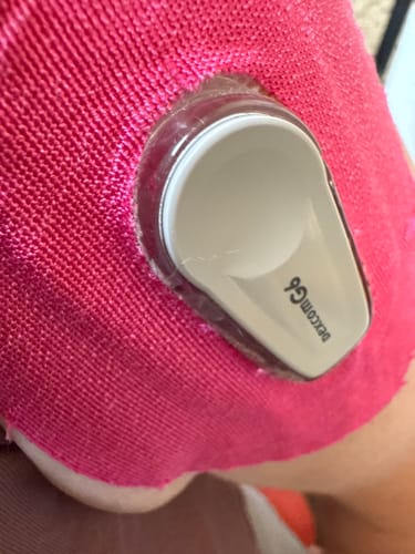 Customer photo review of Skin Grip Original - Dexcom G6 Patches