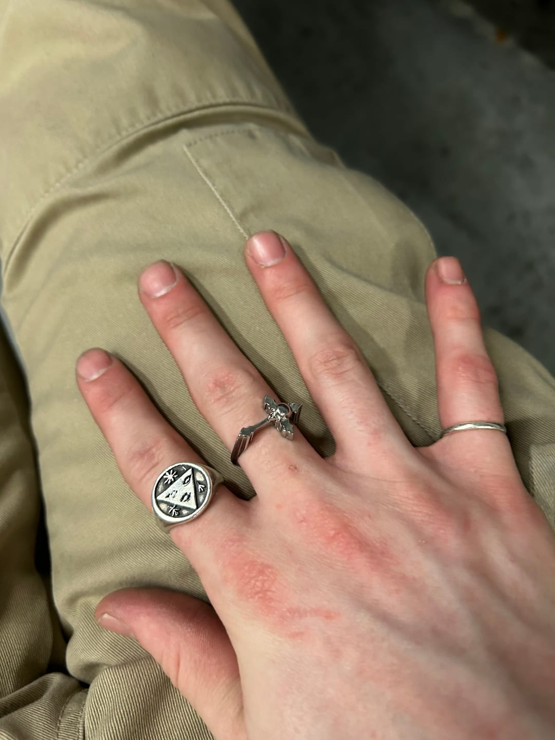 Customer photo review of MINI DYT RING