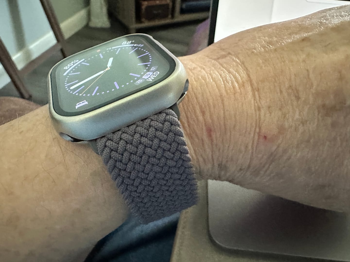 Customer photo review of Terra Loop Band
