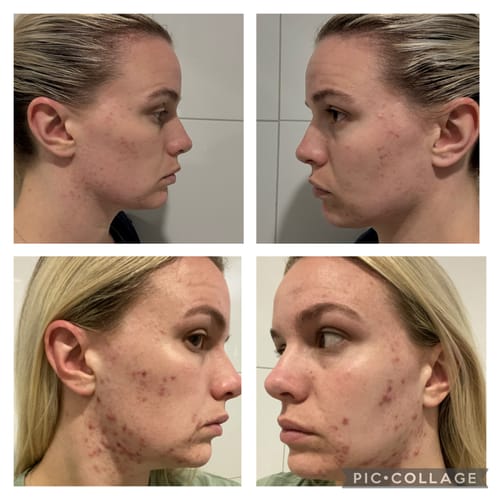 Customer photo review of Skin & Gut Maintain™