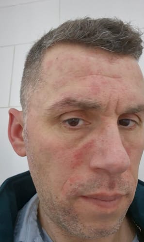 Customer photo review of Seb Natural Calming Serum