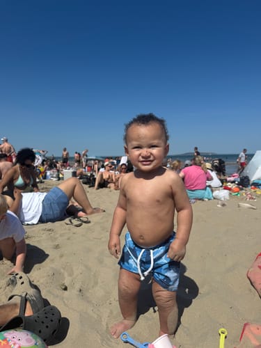 Customer photo review of Calm Balm