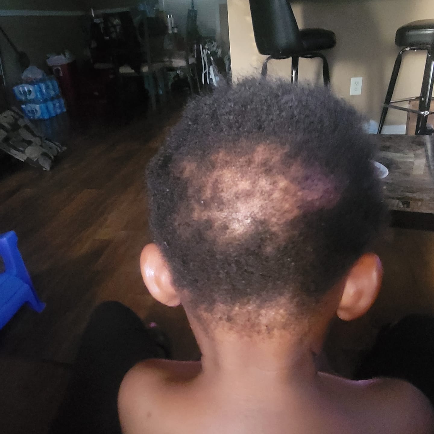 Customer photo review of Hydrating Multi-Use Styling Foam