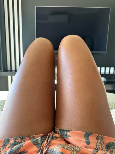 Customer photo review of Ingrown SOS
