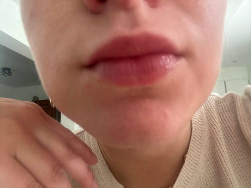 Customer photo review of COSTIQ® EXTREME LIP PLUMPER