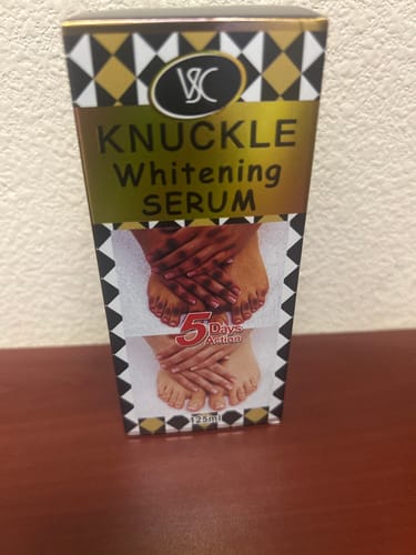 Customer photo review of VSC Knuckle Whitening Serum 5 Days Result 125 ml