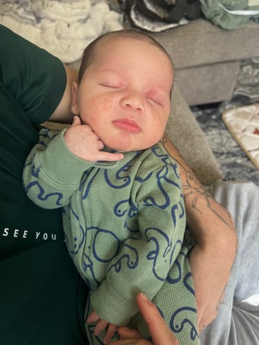 Customer photo review of All Over Ointment Eczema Treatment