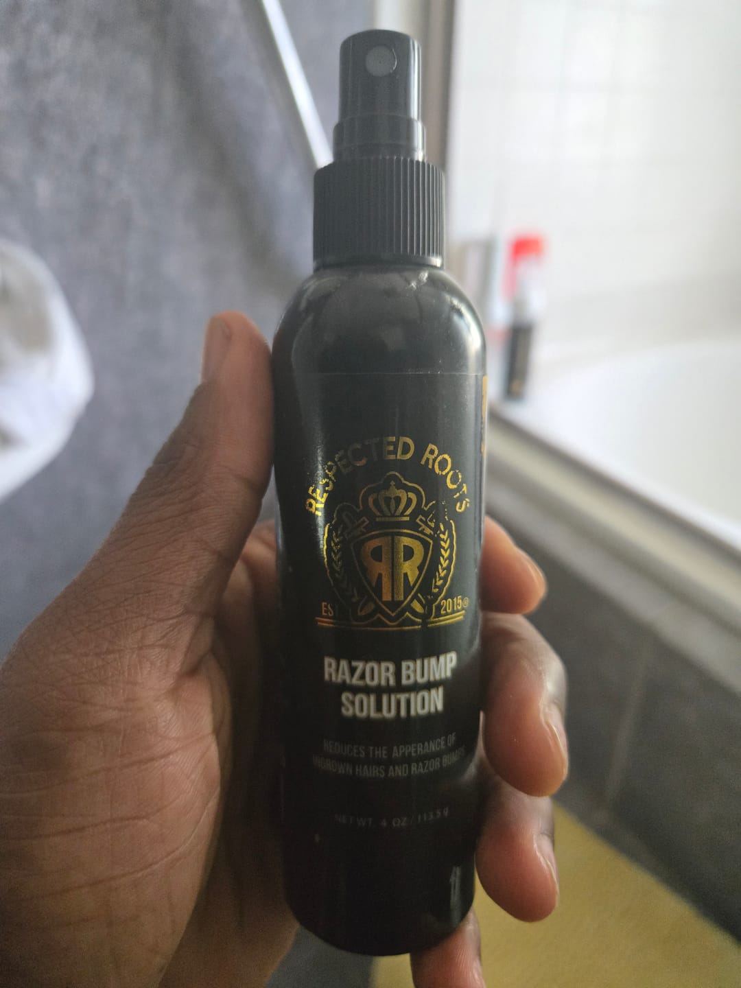 Customer photo review of Razor Bump Solution