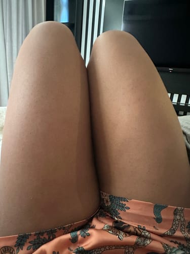 Customer photo review of Ingrown SOS