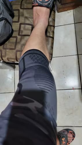 Customer photo review of ReliveX™ KnieBrace