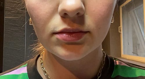 Customer photo review of COSTIQ® EXTREME LIP PLUMPER