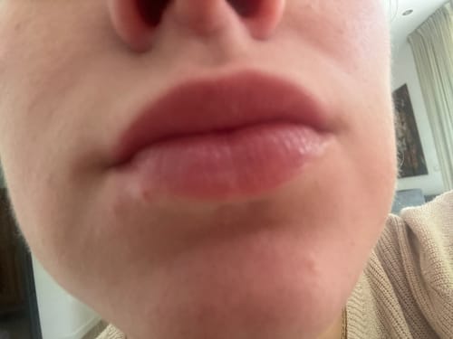 Customer photo review of COSTIQ® LONG LASTING LIP PLUMPER