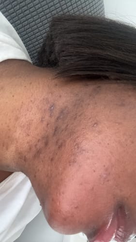 Customer photo review of Turmeric Glow Soap