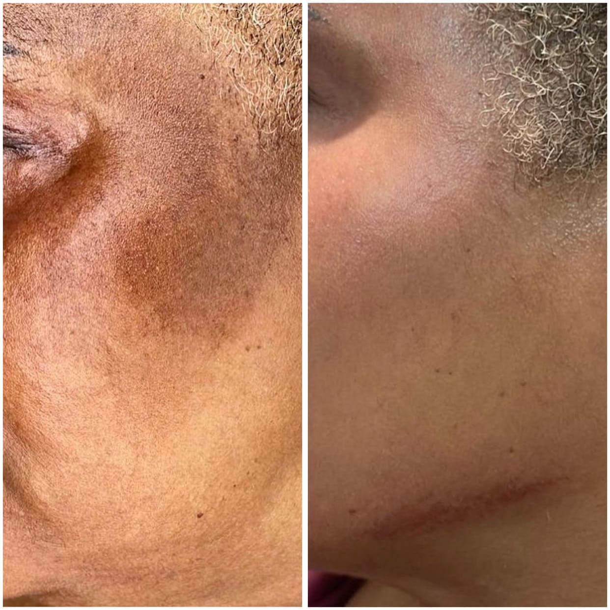Customer photo review of Dark Spots Corrector Cream