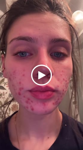 Customer video review of Honey & Turmeric