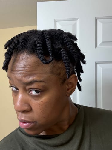 Customer photo review of Root Revive Pro+ - Hair Growth Shampoo