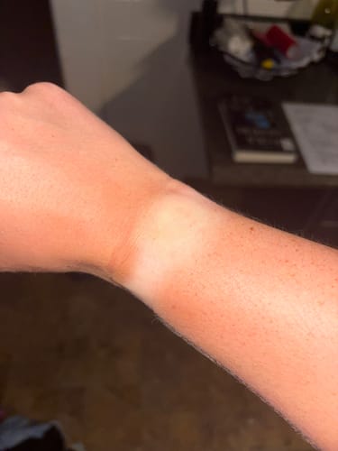 Customer photo review of Complete Glow Bundle