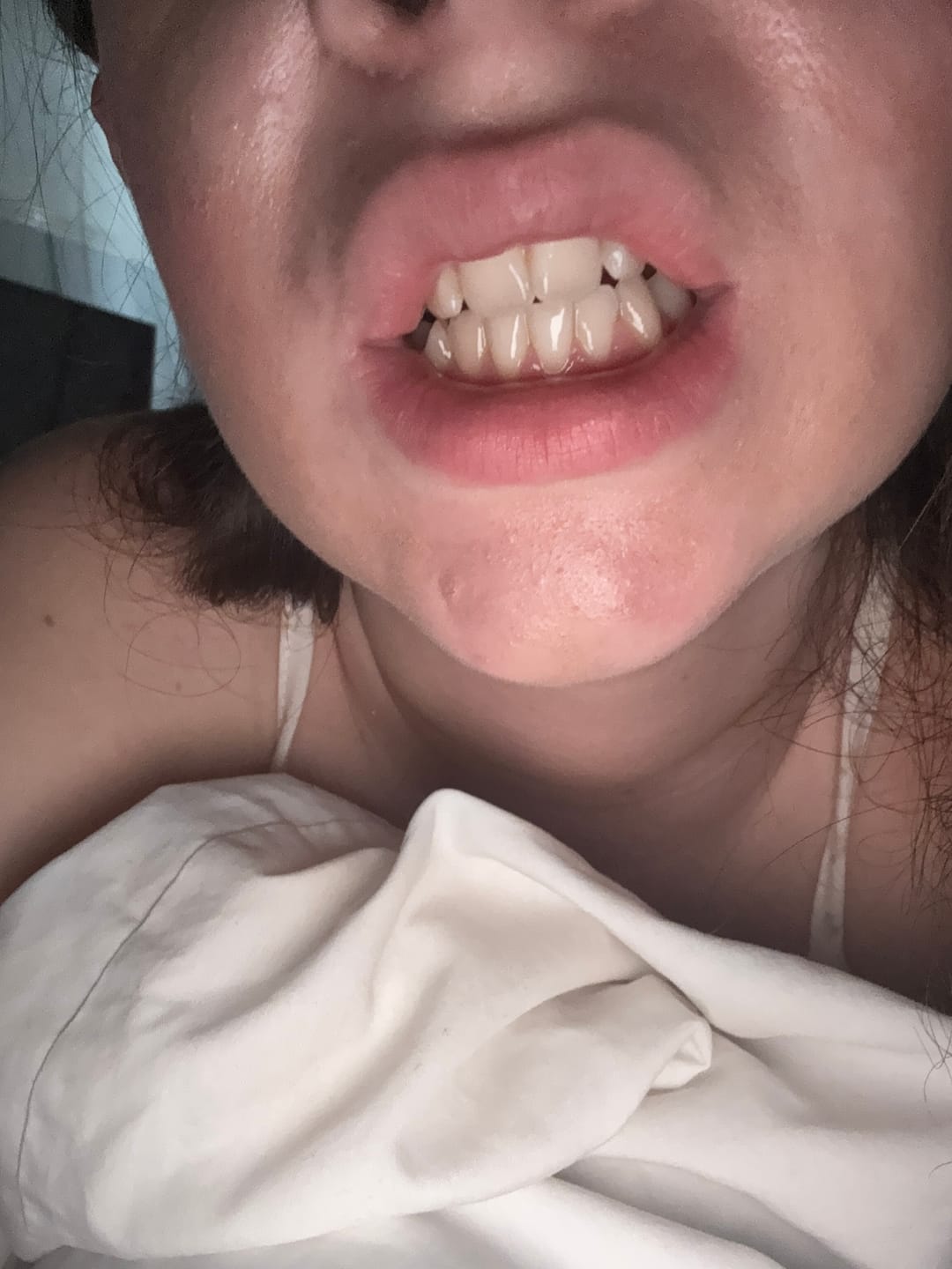 Customer photo review of Strip Together Bundle