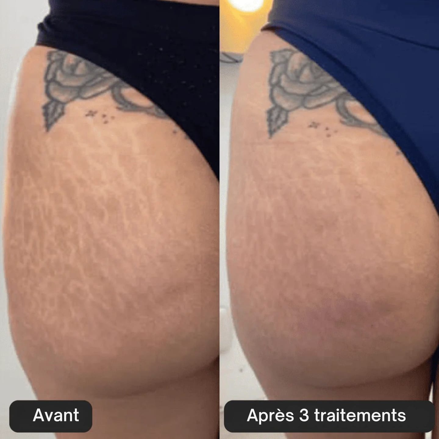 Customer photo review of Kit Glov Beauté Vergeture