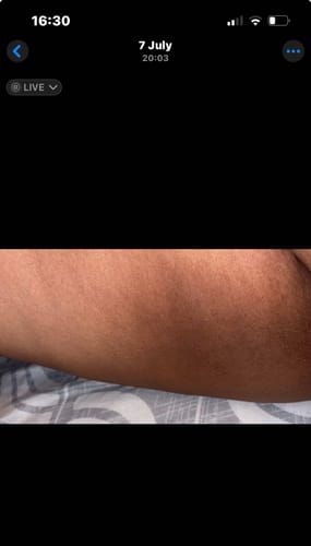 Customer photo review of Bright Skin Bish
