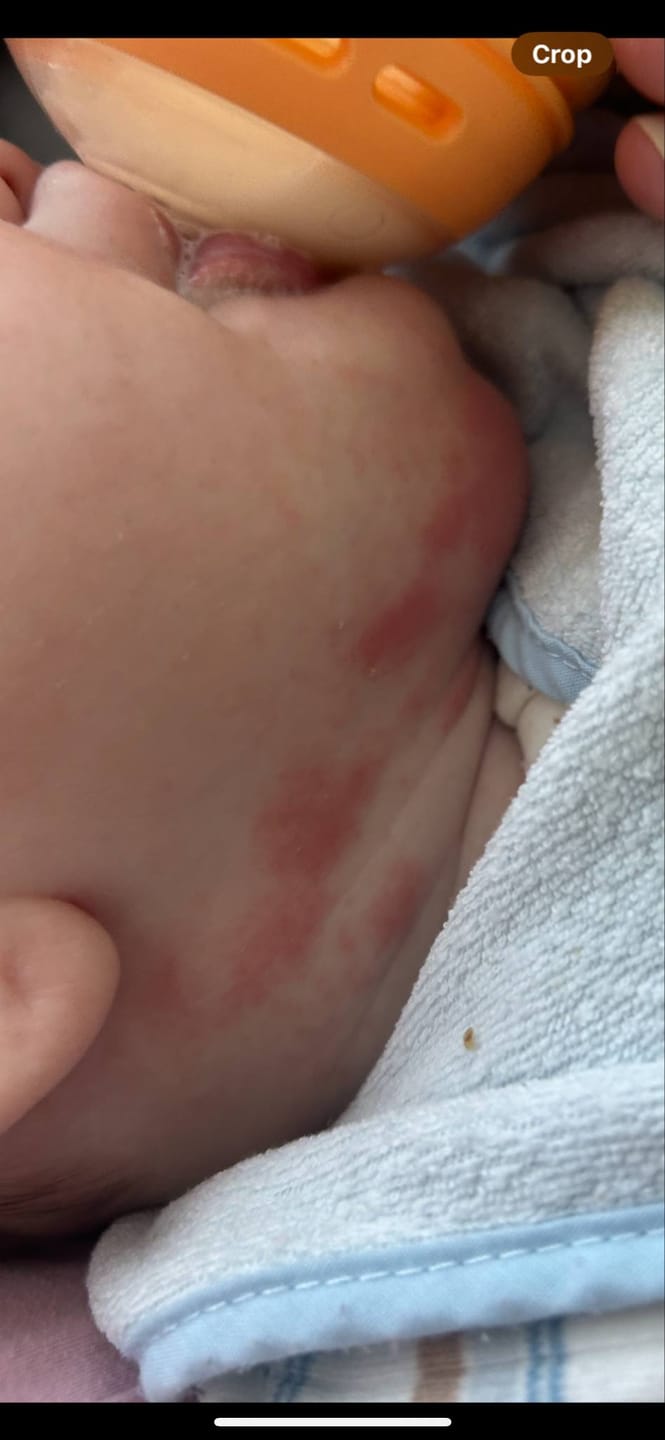 Customer photo review of Bioskin Junior Duo Pack