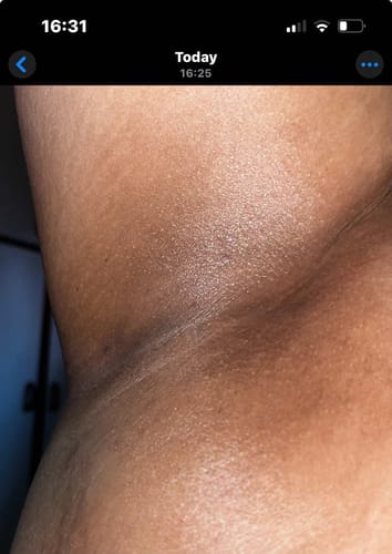Customer photo review of Glow Getter