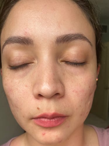 Customer photo review of Formula Personalizada (Rx)