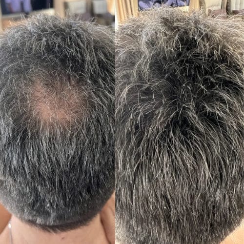 Customer photo review of Camouflage capillaire