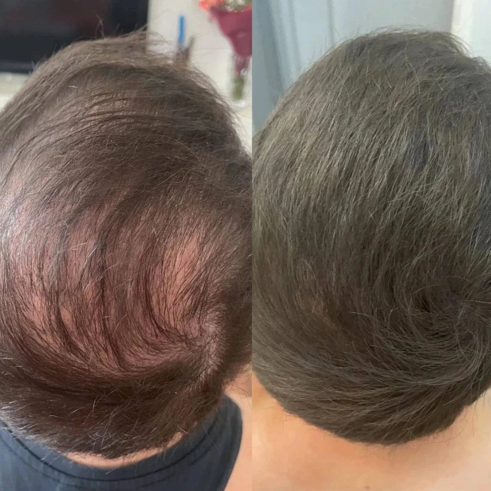 Customer photo review of Camouflage capillaire