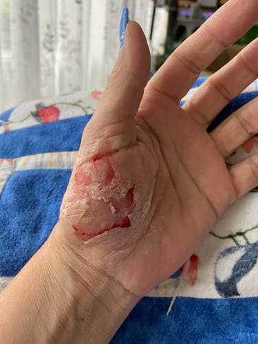 Customer photo review of Neptune Grass Fed Tallow & Honey Balm