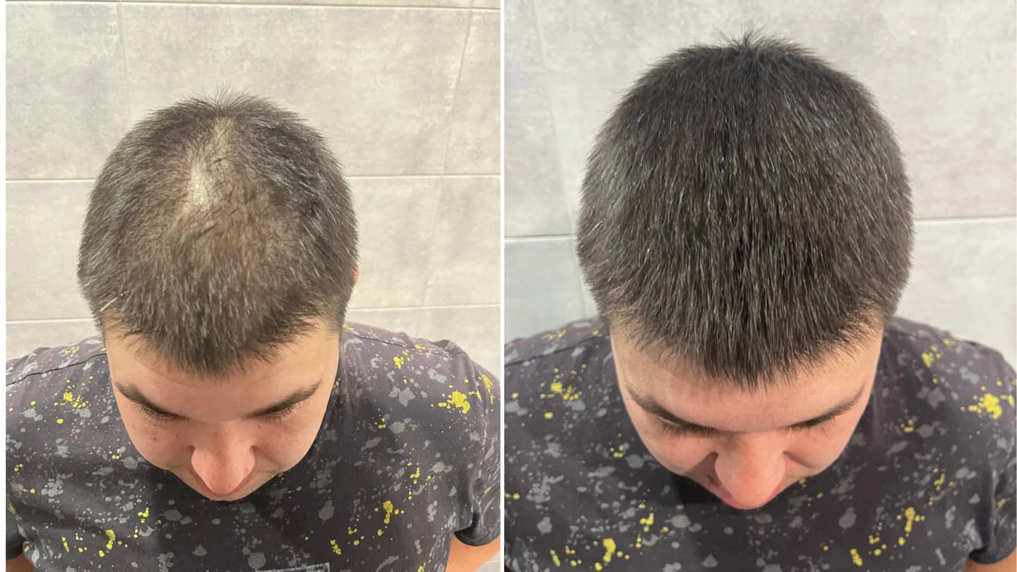 Customer photo review of Camouflage capillaire