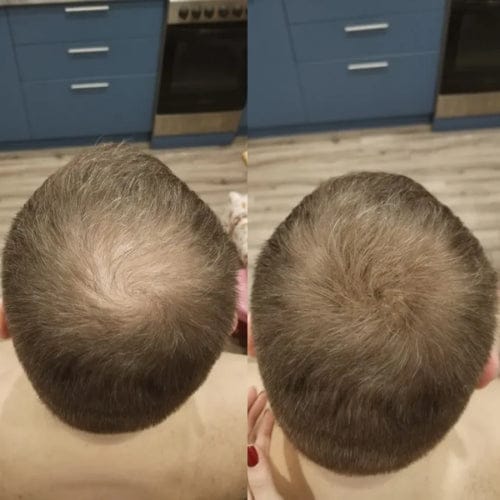 Customer photo review of Camouflage capillaire