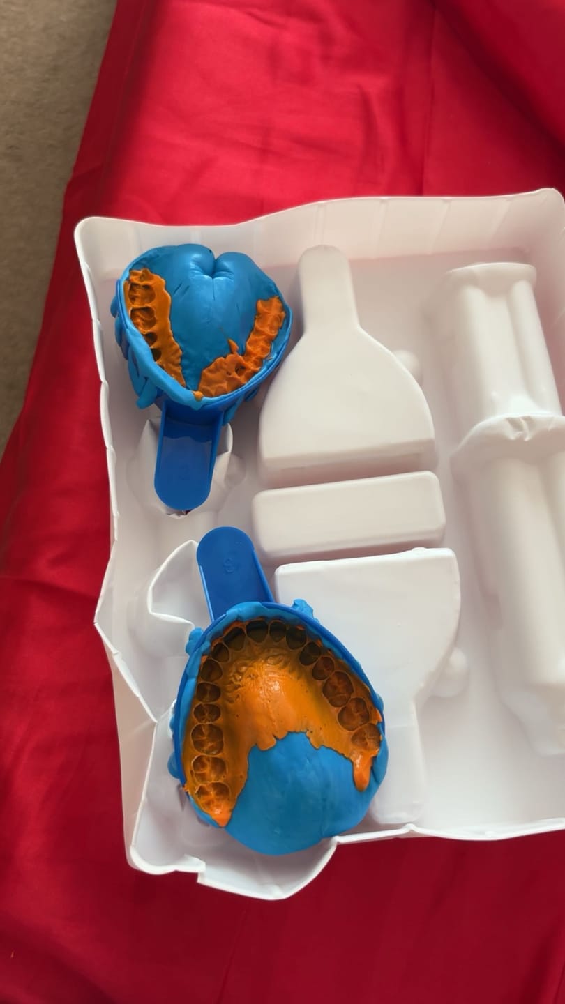 Customer photo review of Upper Impression Kit