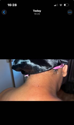 Customer photo review of Bright Skin Bish