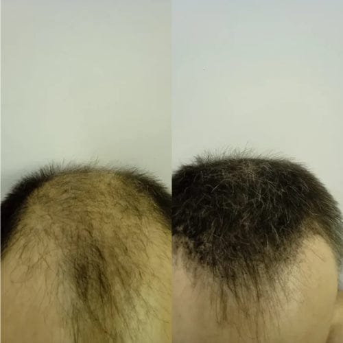 Customer photo review of Camouflage capillaire