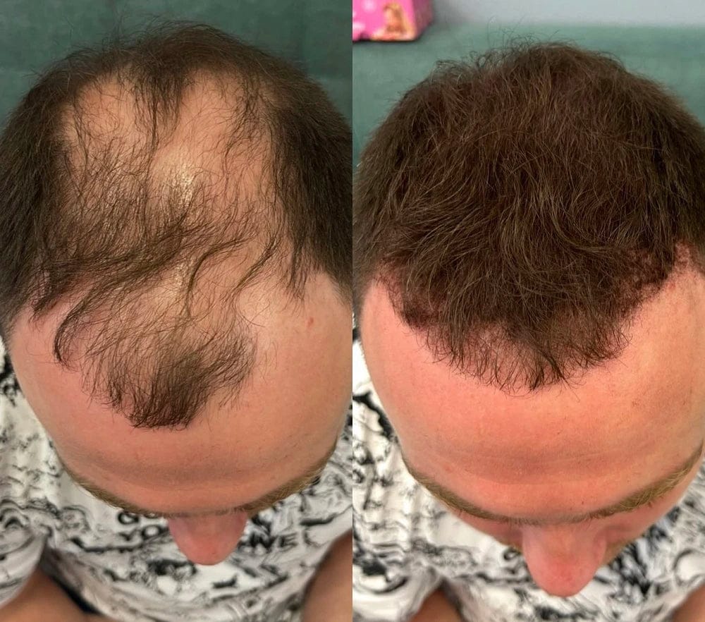 Customer photo review of Camouflage capillaire