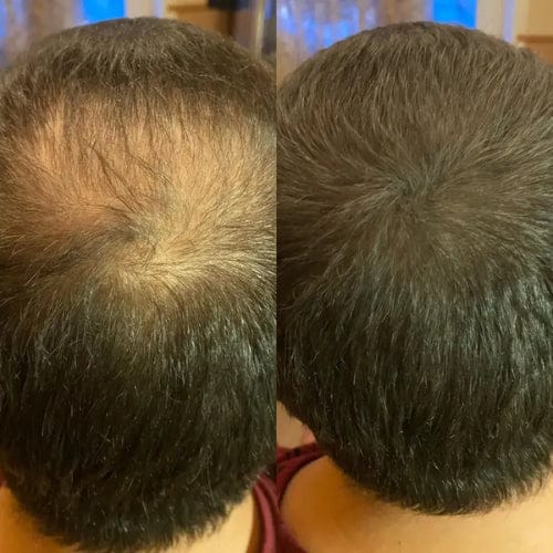 Customer photo review of Camouflage capillaire