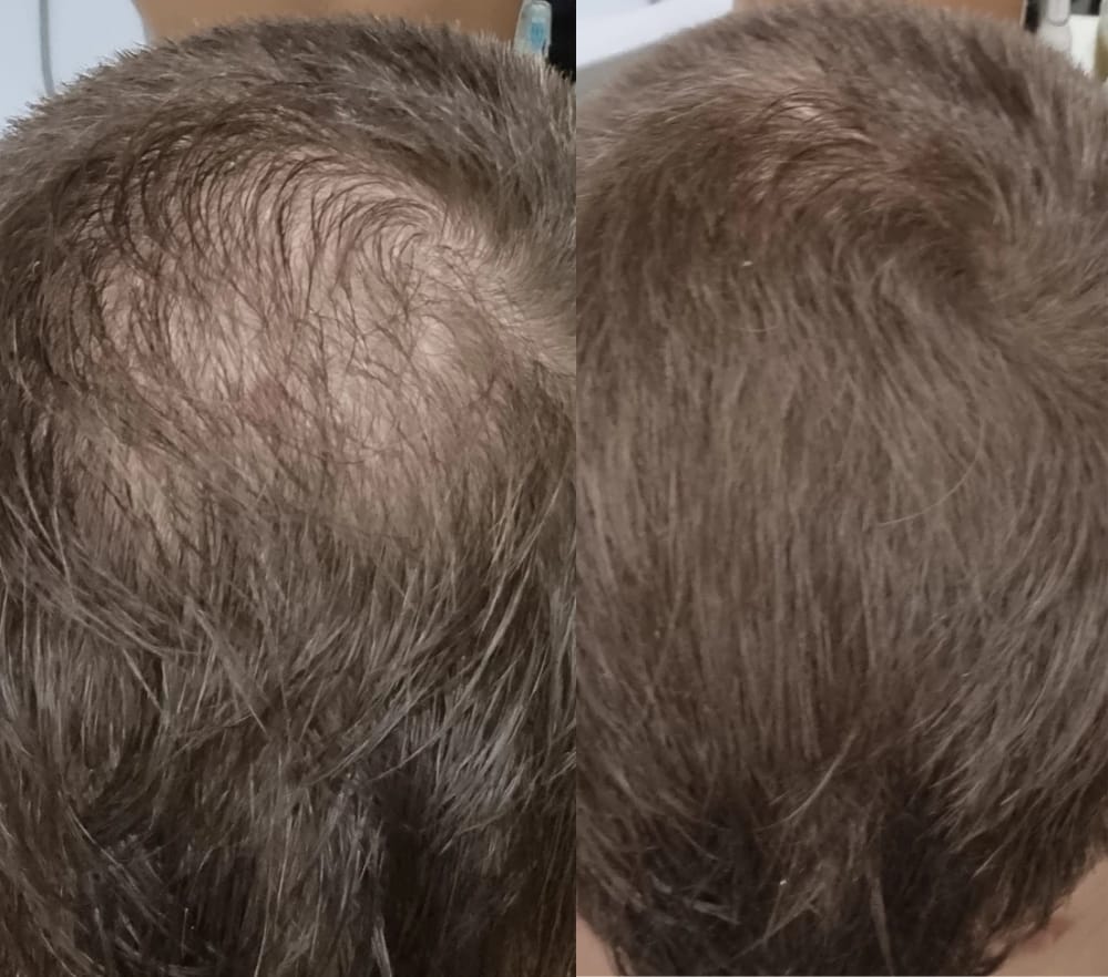 Customer photo review of Camouflage capillaire