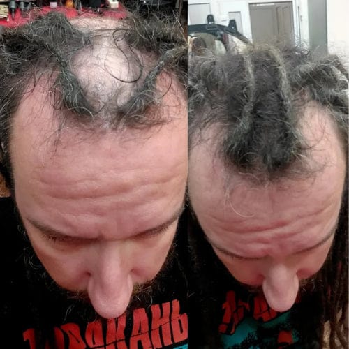 Customer photo review of Camouflage capillaire